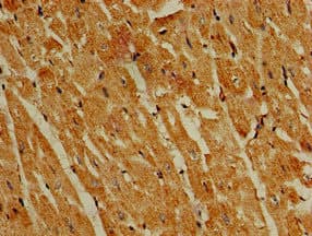 Polyclonal Rabbit anti-Human PIK3R4 Antibody (IHC, IF)