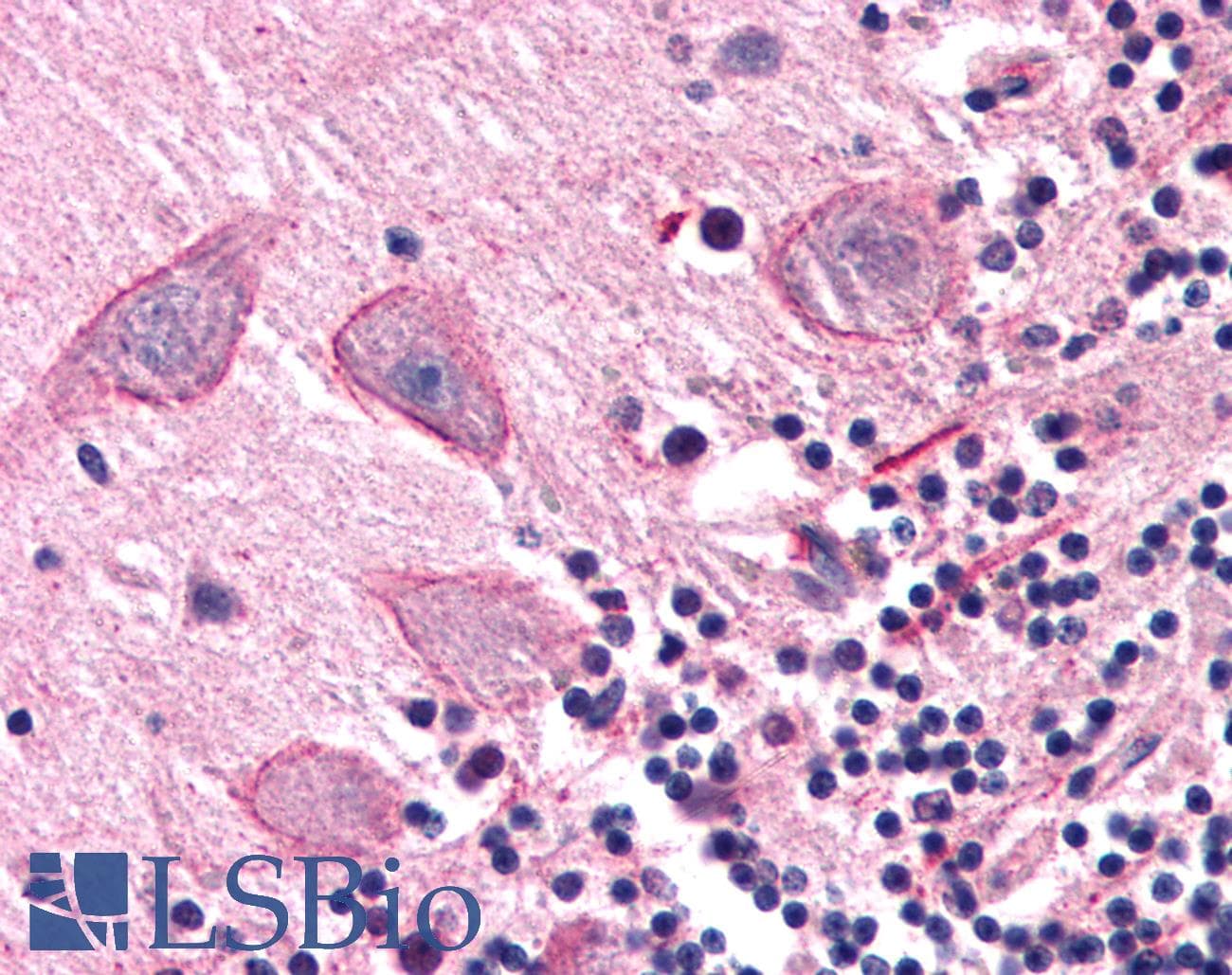 IHC-plus™ COMT Antibody (Internal)