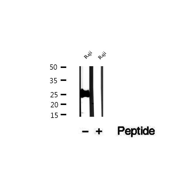 PCMT1 Antibody