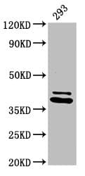 Polyclonal Rabbit anti-Human PSMD7 / MOV34 Antibody (IHC, WB)