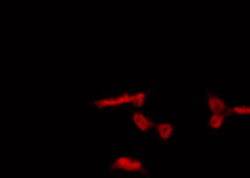 AHR Antibody (phospho-Ser36)