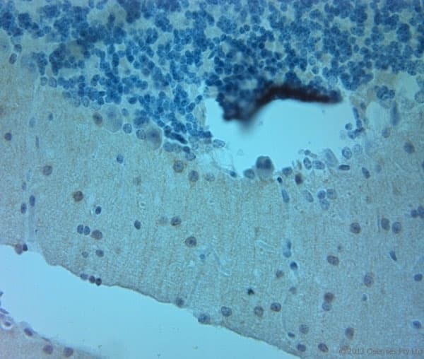 Polyclonal Rabbit anti-Human NOS1 / nNOS Antibody (aa1390-1434, IHC)