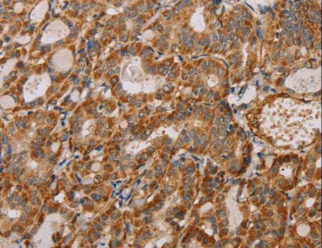 MTFR1 Antibody