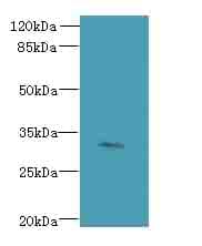 Polyclonal Rabbit anti-Human FAM78A Antibody (IHC, WB)