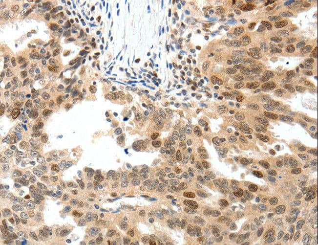 IHC-plus™ TOP2A / Topoisomerase II Alpha Antibody