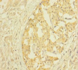CLTB Antibody