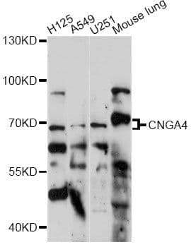 Polyclonal Rabbit anti-Human CNGA4 Antibody (WB)
