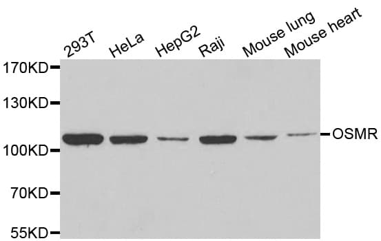 Polyclonal Rabbit anti-Human OSMR / IL-31R-Beta Antibody (IHC, WB)