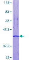 Human CRABP1 / CRABP Protein (Recombinant GST)