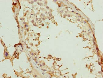 WDR47 Antibody