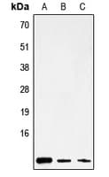 MT-ATP8 Antibody (Internal)