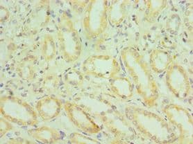 HYAL2 Antibody (aa367-473)