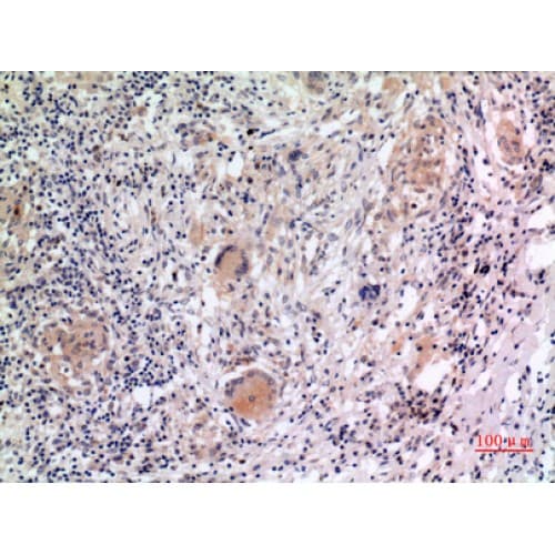 NALP3 / NLRP3 Antibody (501-550 aa, Internal)