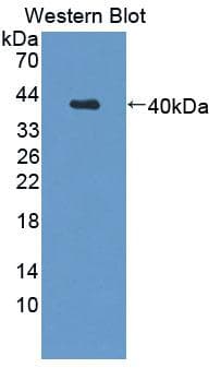 CAPN5 / Calpain 5 Antibody (HRP)