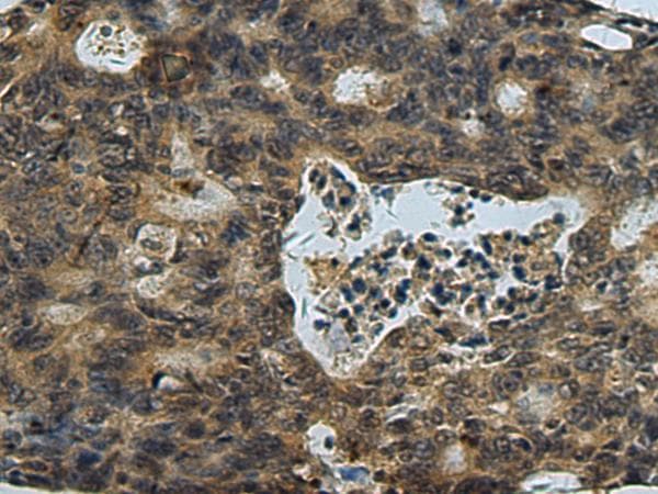 PLTP Antibody