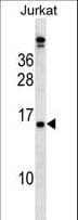 PLAC4 Antibody (aa20-48)