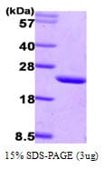 Human CIB1 / KIP Protein (Recombinant His)