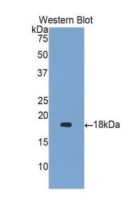 GKN1 / Gastrokine 1 Antibody (aa53-192, Biotin)