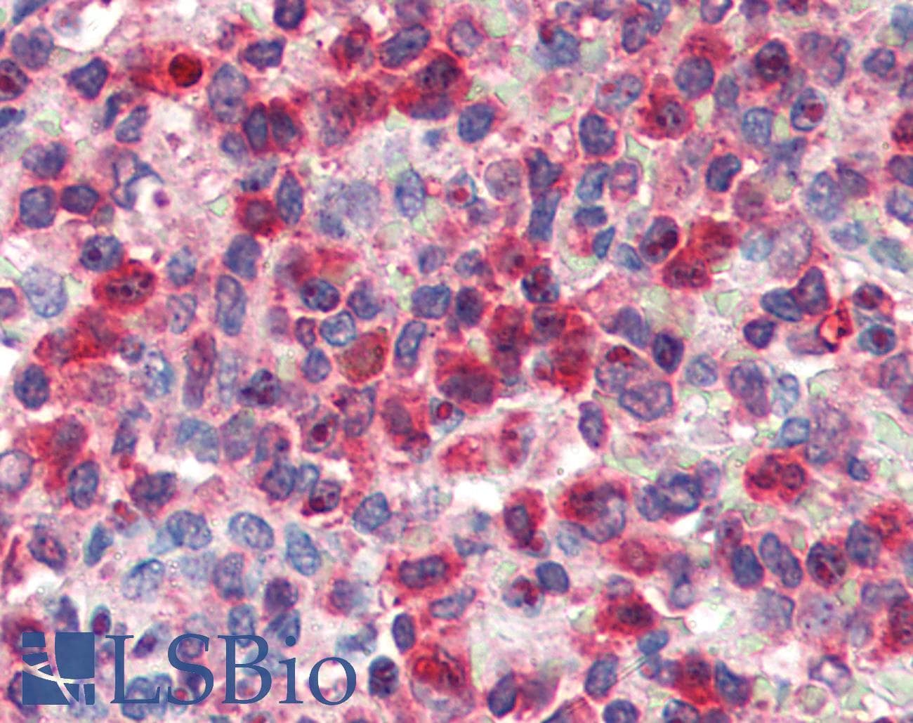 IHC-plus™ G6PD Antibody (aa308-320)