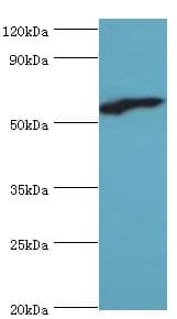 RBBP5 Antibody (aa319-538)