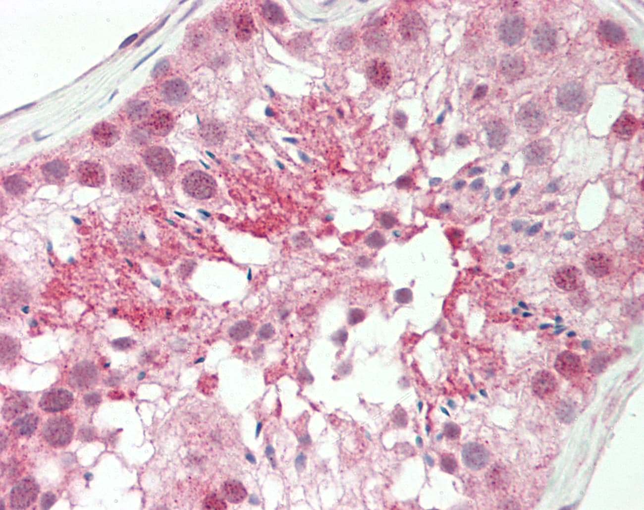 CNOT4 / CLONE243 Antibody (aa36-85)
