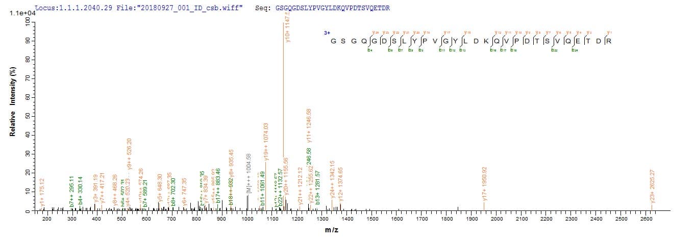 Human TMEM85 Protein (Recombinant 10His, N-terminus)