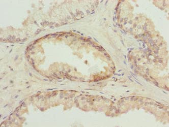 TUBB6 / Tubulin Beta 6 Antibody (aa1-446)