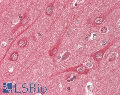 IHC-plus™ CLASP2 Antibody (N-Terminus, clone KT69)