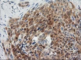 OSBP Antibody (clone OTI1A4)