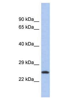 C9orf173 Antibody (aa67-116)
