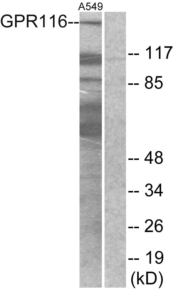IHC-plus™ Polyclonal Rabbit anti-Human ADGRF5 / GPR116 Antibody (aa11-60, IHC, IF, WB)