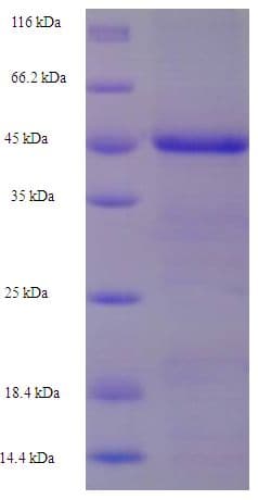Human BIRC1 / NAIP Protein (Recombinant His-SUMO)