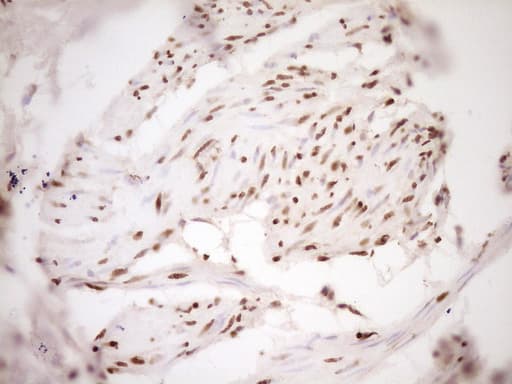 SAE1 Antibody (clone OTI6C7)