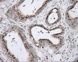 ACSBG1 / hsBG Antibody (clone OTI2B5)