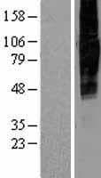 SLC34A2 / NaPi-2b Protein (Over-Expression Lysate Myc-DDK (Flag))