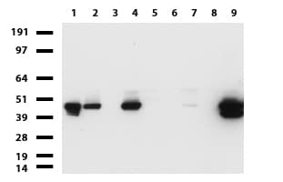 KRT19 / CK19 / Cytokeratin 19 Antibody (aa240-390, clone UMAB186)