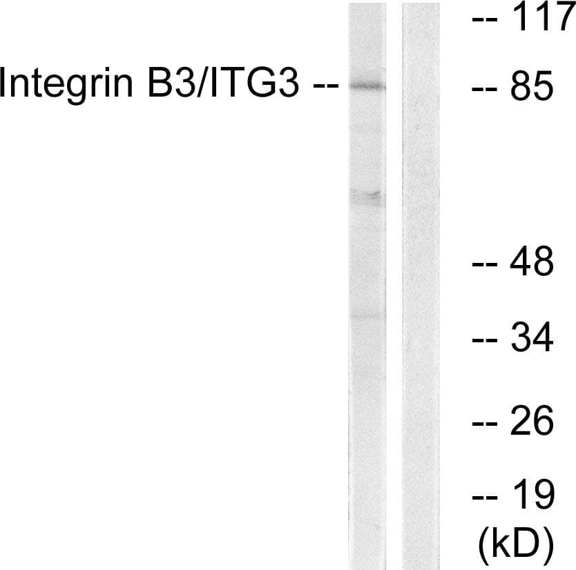 ITGB3 / Integrin Beta 3 / CD61 Antibody (p785)