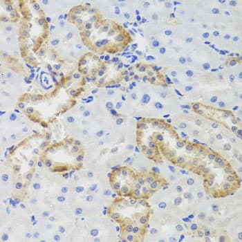 Polyclonal Rabbit anti-Human MTERF2 / MTERFD3 Antibody (IHC, WB)