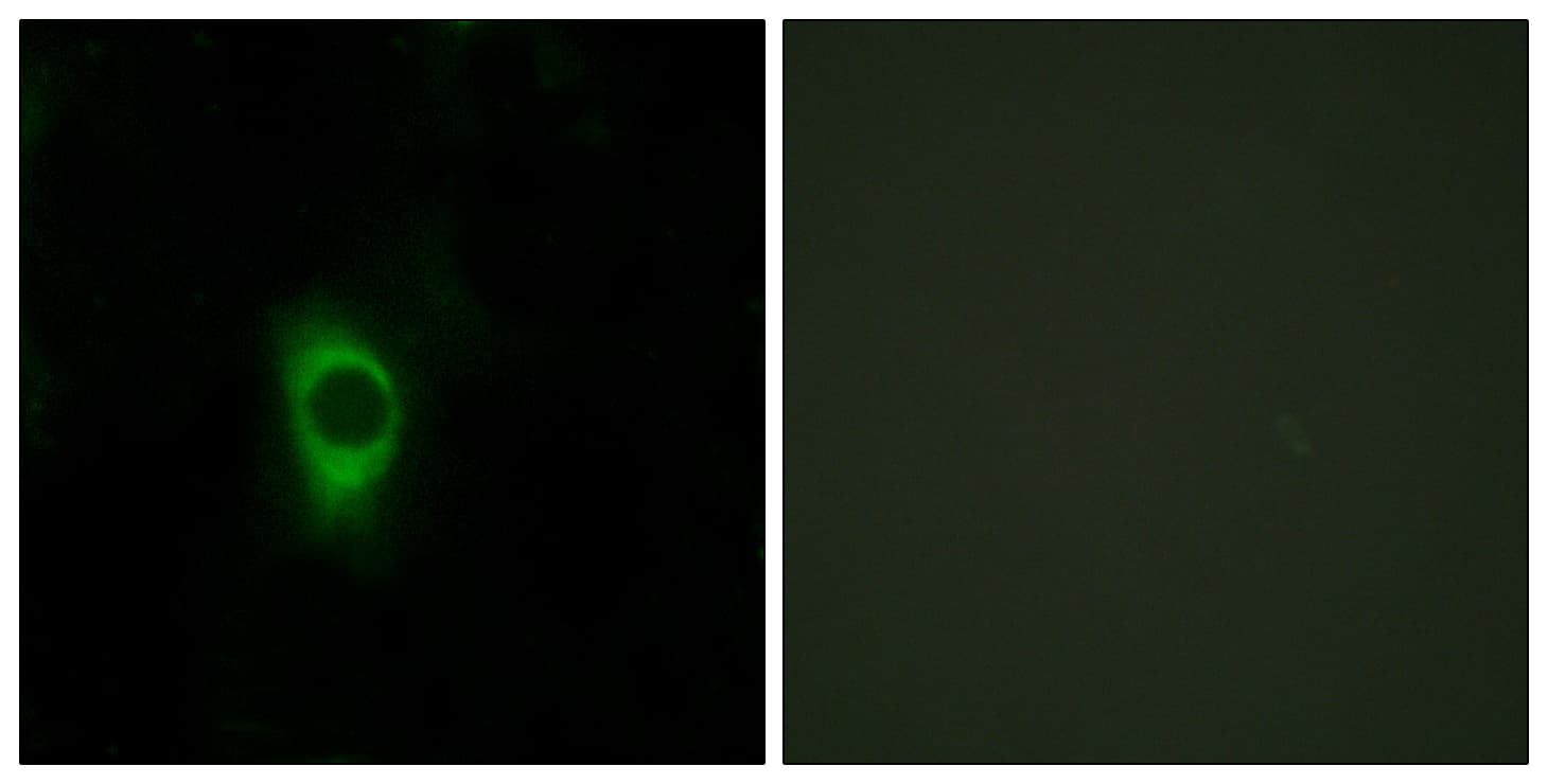 HTR2B / 5-HT2B Receptor Antibody (aa261-310)