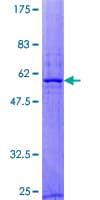Human RAB40B Protein (Recombinant GST)