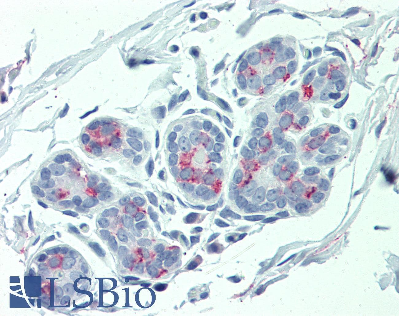 IHC-plus™ ITGA6/Integrin Alpha 6/CD49f Antibody (Internal)