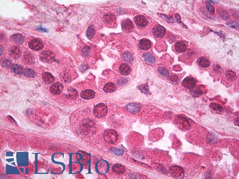 IHC-plus™ HSP40 Antibody