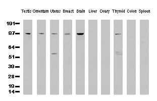 Monoclonal Mouse anti-Human ERCC4 / XPF Antibody (clone UMAB20, IHC, IF, WB)