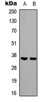 Polyclonal Rabbit anti-Human PAX1 Antibody (Internal, IHC, WB)