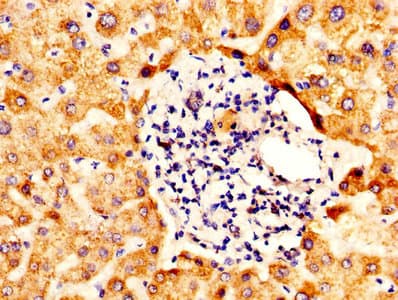 Polyclonal Rabbit anti-Human ALDH5A1 Antibody (aa48-535)
