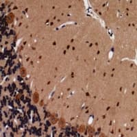 CD144 / CDH5 / VE Cadherin Antibody