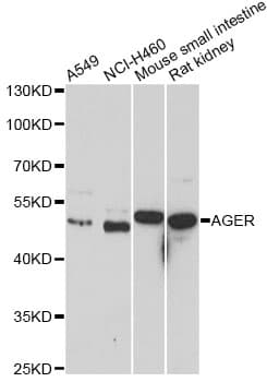 AGER / RAGE Antibody