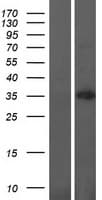 Human MBLAC1 Protein (Over-Expression Lysate Myc-DDK (Flag))