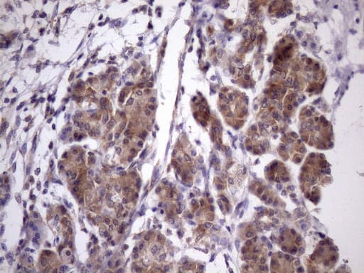 Vps60 / CHMP5 Antibody (clone OTI5C7)