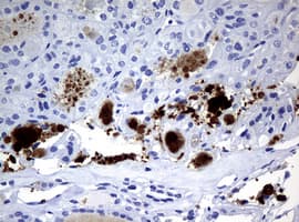 WFDC2 / HE4 Antibody (aa31-124, clone OTI2A7, Carrier-free)